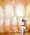 وصفات تبييض الاسنان وسؤال وجواب حلو تنظيف الاسنان وعلاج تسوس واصفرار الأسنان 2023 3