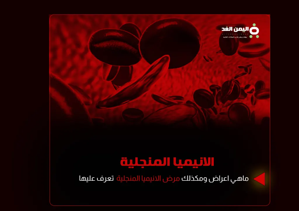 الانيميا المنجلية ماهو مرض تحليل الانيميا المنجلية وهل يمكن علاجها فقر الدم anemia الانيميا المنجلية ماهو مرض تحليل الانيميا المنجلية وهل يمكن علاجها فقر الدم anemia