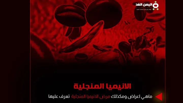 الانيميا المنجلية ماهو مرض تحليل الانيميا المنجلية وهل يمكن علاجها فقر الدم anemia