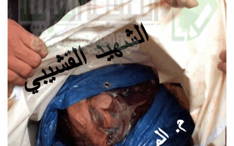 صور جثة اللواء حميد القشيبي بعد مقتلة في عمران