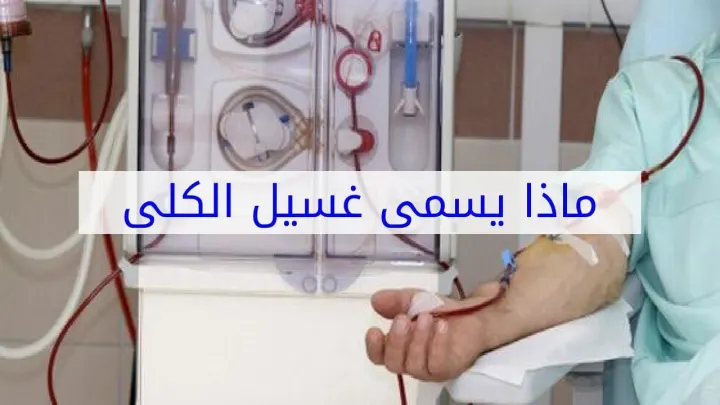 ماذا تسمى عملية غسل الكلى ؟