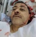 إغتيال عبدالكريم الخيواني ،صور قتل الخيواني من قبل مجهولين 4