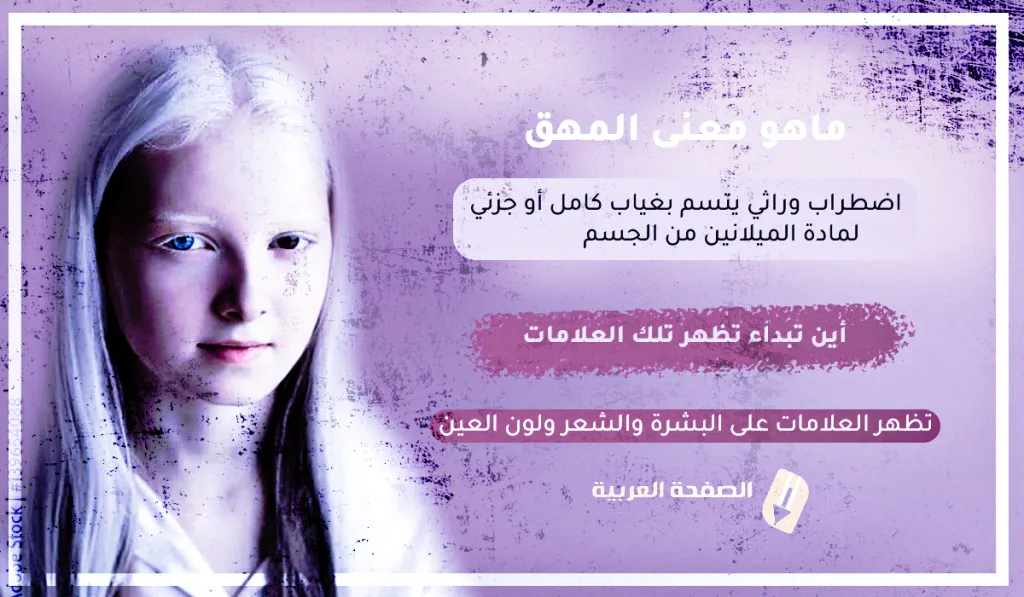 معنى مرض المهق albinism اين تبداء تظهر اعراض المهق