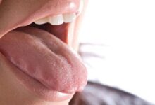 علاج رائحة الفم