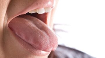 طريقة علاج رائحة الفم الكريهة 2024 كيف جعل رائعة الفم غير كريهة