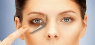 أسباب الهالات السوداء وطرق علاجها بالأعشاب
