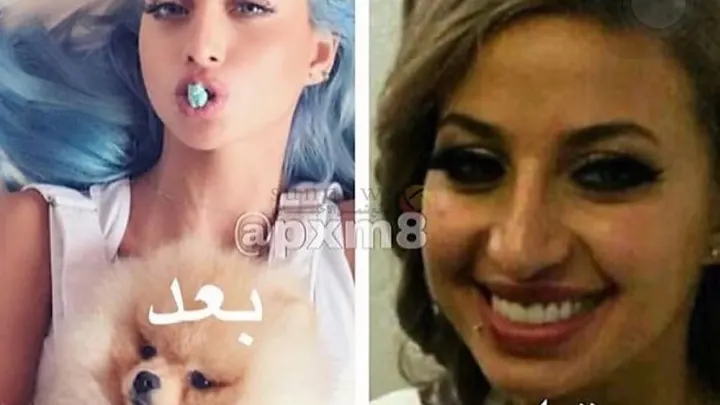 حقيقة فضيحة مودل روز قبل بعد عملية التجميل